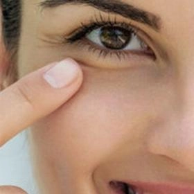 Кантопластика