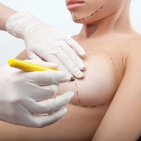 Пластика грудей