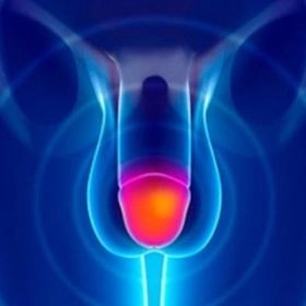 Обрізання крайньої плоті