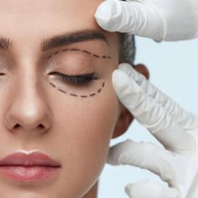 Блефаропластика до -15%