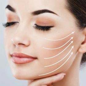 Підтяжка обличчя