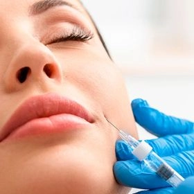 Ліпофілінг носогубних складок