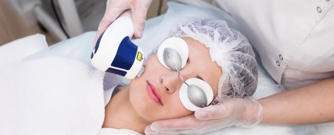 Лазерна епіляція обличчя в Одесі