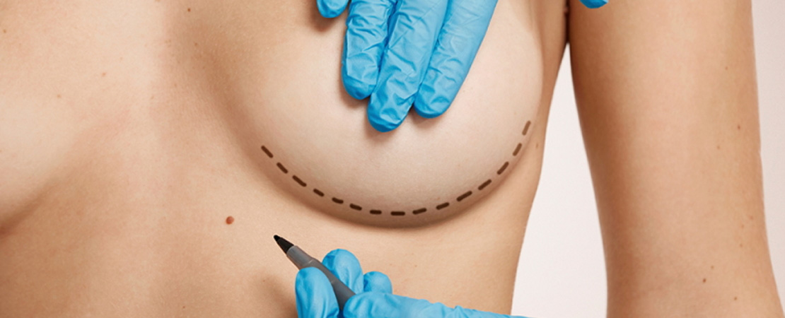 Ліпофілінг грудей в Одесі