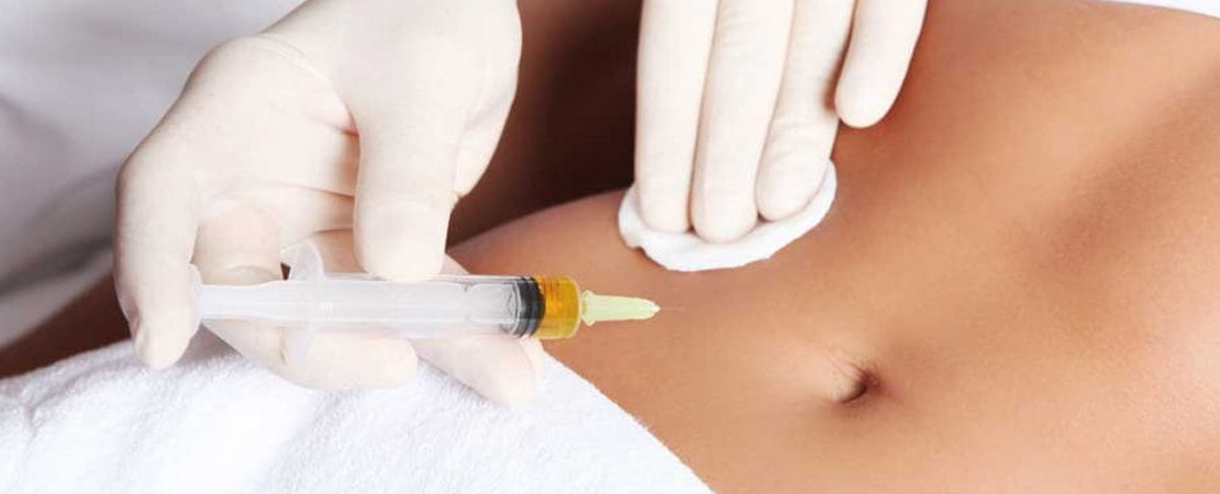 Мезотерапія тіла в Одесі