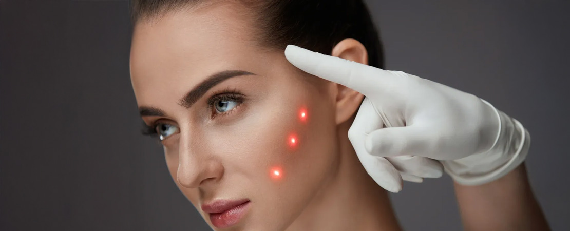 Лазерне шліфування постакне в Одесі.