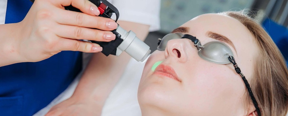 Лазерна епіляція верхньої губи в Одесі.