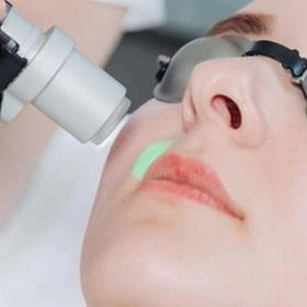 Верхня губа