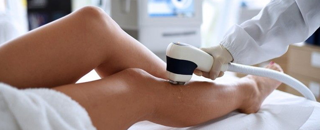 Лазерна епіляція ніг в Одесі