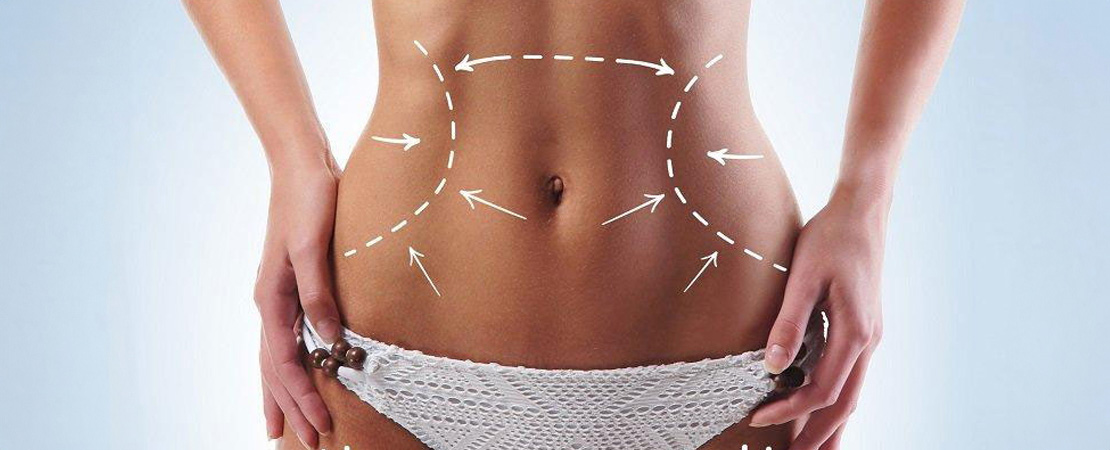 Ультразвуковий SMAS-ліфтинг тіла в Одесі.