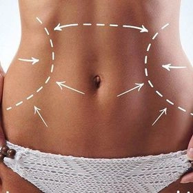 Ультразвуковий SMAS-ліфтинг тіла