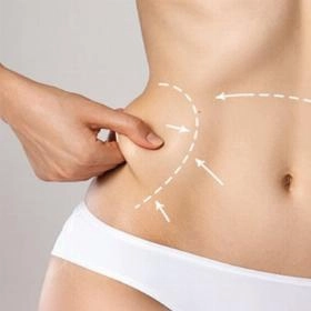 Ліпосакція боків