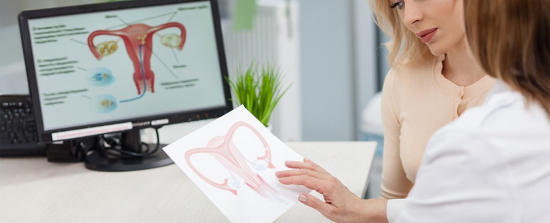 Лазерне лікування опущення піхви та матки в Одесі.