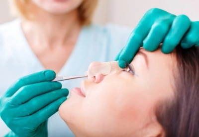 Етапи проведення ринопластики