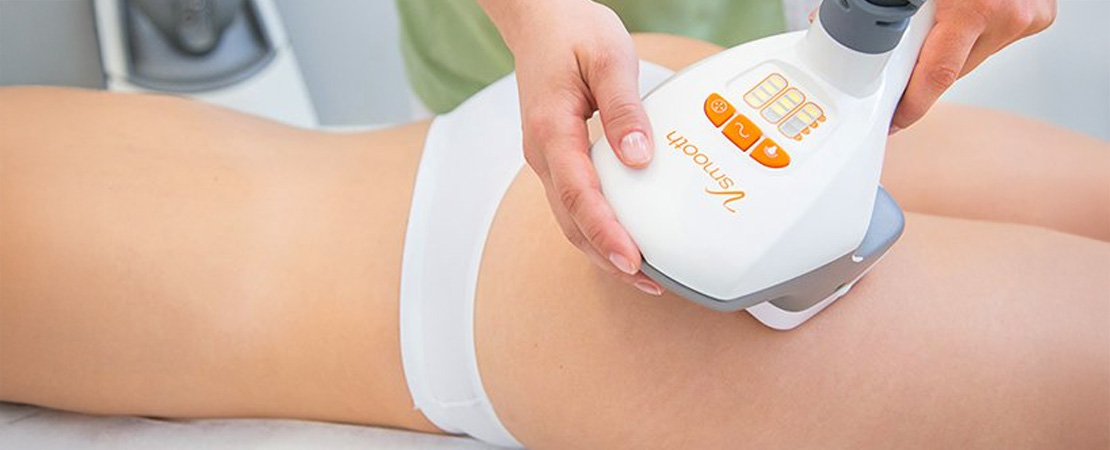 Ліполіз та підтяжка шкіри VelaShape в Одесі