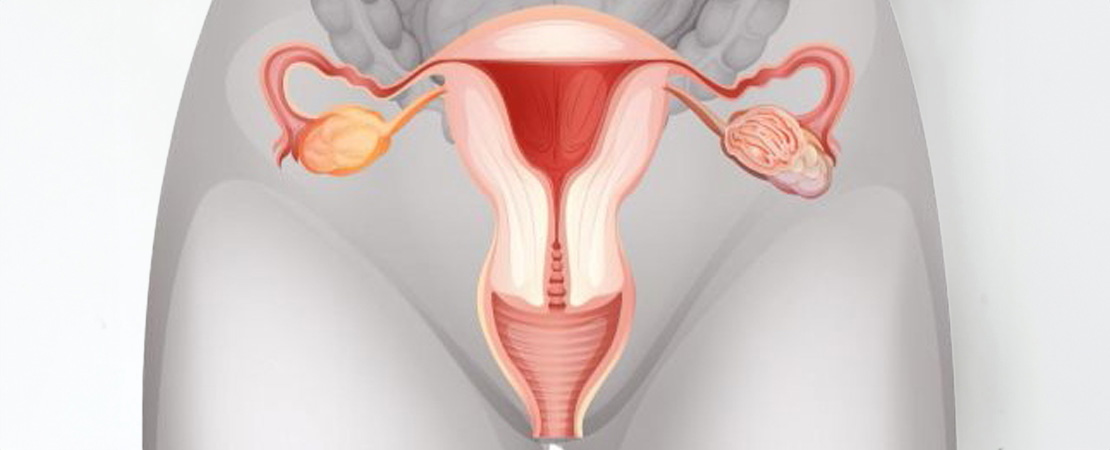 Ультразвукове омолодження піхви в Одесі.