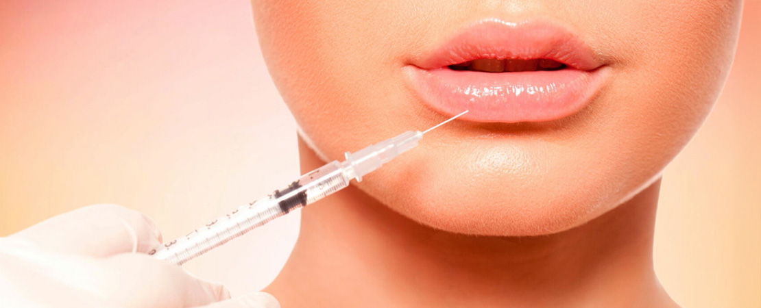 Ліпофілінг губ в Одесі
