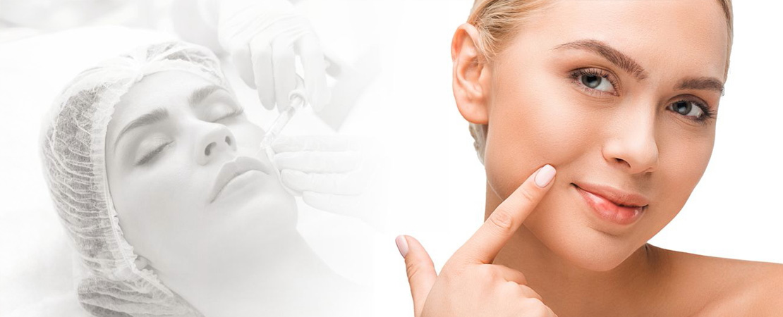 Корекція носогубних складок в Одесі.