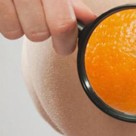 Лікування целюліту 