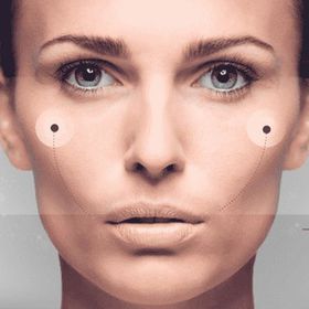 Пластика вилиць до -20%