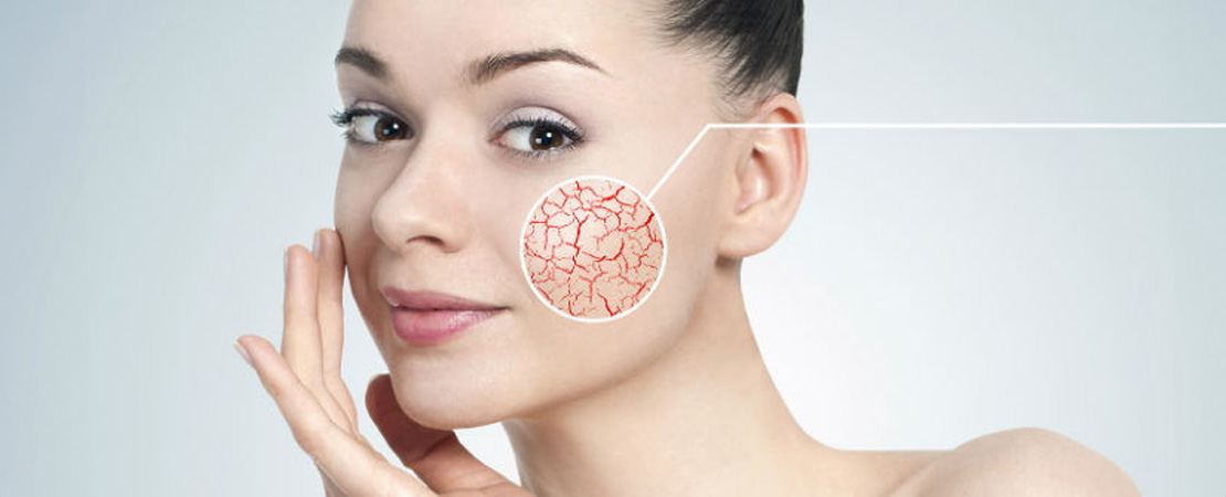 Лазерне видалення судин в Одесі.