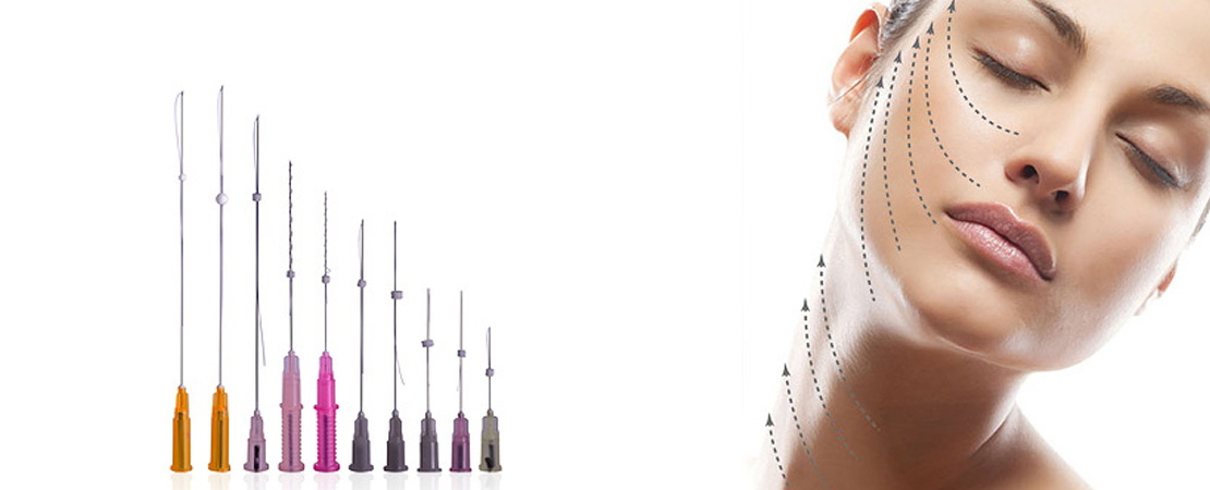 Мезоніті 3D (тредліфтинг) в Одесі