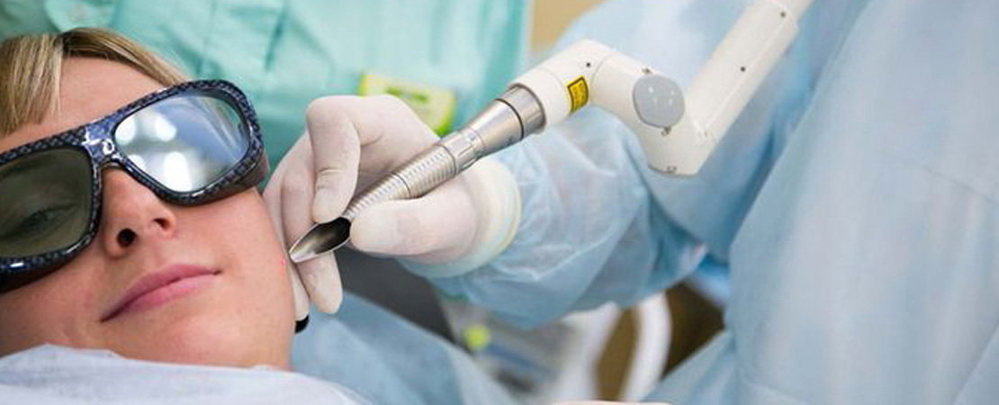 Лазерне видалення папілом в Одесі