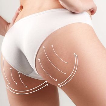 Ліпофілінг або імплантати. Що вибрати?