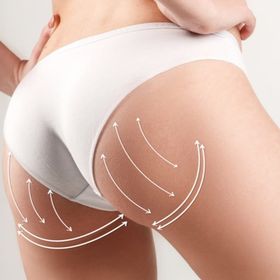 Ліпофілінг або імплантати. Що вибрати?