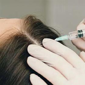 Мезотерапія голови -10%