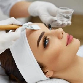 Хімічний пілінг