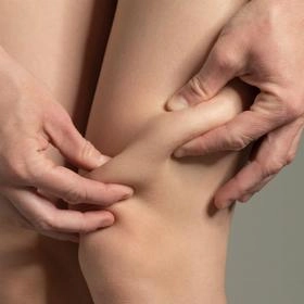 Ліпосакція колін